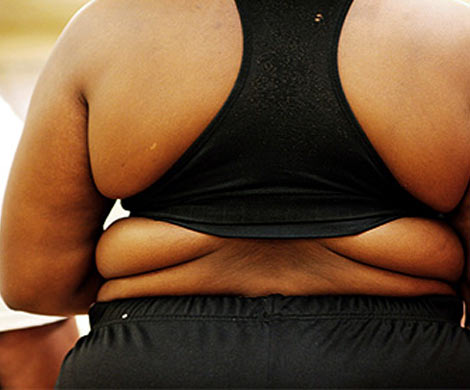Чернокожие оказались склонными к ожирению