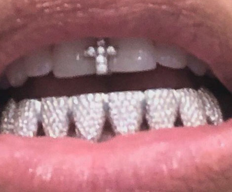 Ким Кардашьян украсила рот бриллиантами