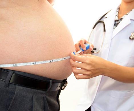 Ожирение сокращает продолжительность жизни на восемь лет 