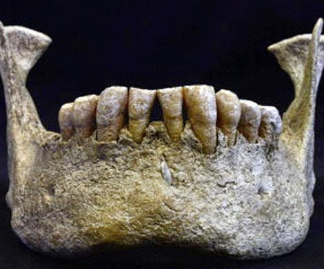 Первые стоматологи появились в каменном веке