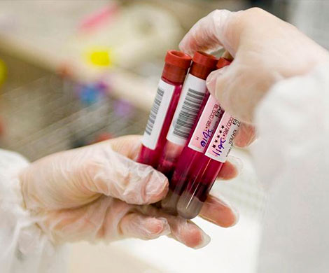 В Канаде ученые создали универсальную донорскую кровь