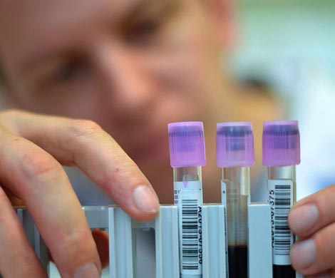 Американские ученые обнаружили эффективное средство против ВИЧ