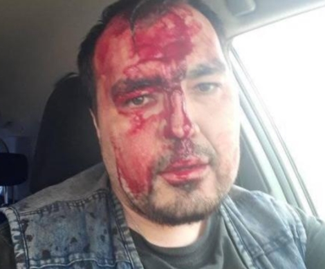 В Улан-Удэ кандидат в депутаты избил журналиста