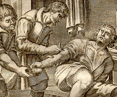 Лечение болезней в древности: названы самые дикие методики