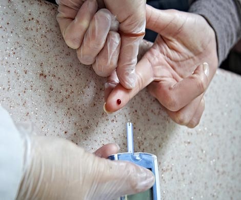 Люди, больные диабетом 1 типа, стареют раньше остальных