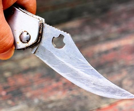 Петербуржец ранил себя ножом в спину и поехал в больницу
