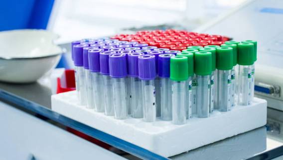 Regeneron останавливает исследование лечения антителами тяжелобольных пациентов с коронавирусом