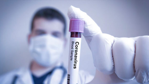 Roche Holding выпустит тест на антитела к Covid-19