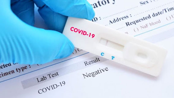 США анонсировали сделку с Abbott Laboratories о покупке 150 млн экспресс-тестов на Covid-19