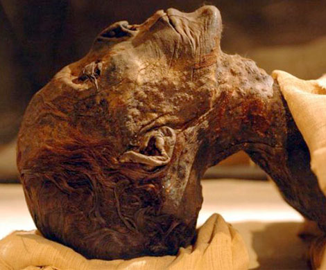 Ученые нашли рак у египтянина, жившего 3000 лет назад