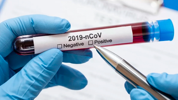 Ученые-ядерщики занялись разработкой дешевых экспресс-тестов на коронавирус
