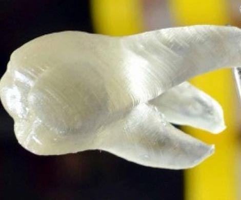 Зубы, напечатанные на 3D-принтере, могут убивать бактерии