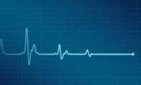 Дефектные гены могут заставить сердце остановиться?
