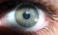 Медики узнали, почему у людей дергается глаз
