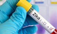 На Олимпиаде в Рио может быть использована российская технология диагностики вируса Зика