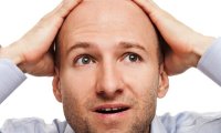 Облысение меняет представление окружающих об успешности мужчины