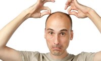 Облысение указывает на проблемы с фертильностью