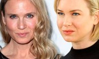 Пластика изменила лицо Рене Зеллвегер до неузнаваемости