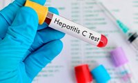 Роспотребднадзор пугает эпидемией гепатита 