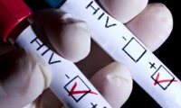 Роспотребнадзор сообщил о росте среднемноголетних показателей по ВИЧ на 43%