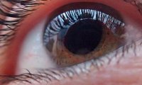 Создан умный гель, спасающий от слепоты
