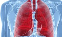 Стало известно, почему рак чаще поражает легкие и кости