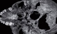 Ученые связали гибель Ричарда III с ранением в основание черепа
