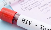 Ученые: в России появилась более опасная версия ВИЧ