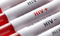 В 13 регионах России более 1% населения заражено ВИЧ