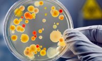 В США обнаружена устойчивая к антибиотикам "супербактерия"