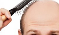 Восстановить шевелюру помогут лекарства от рака и артрита
