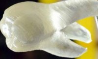 Зубы, напечатанные на 3D-принтере, могут убивать бактерии
