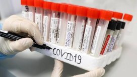 Роспотребнадзор: болеть гриппом стали меньше, но COVID-19 продолжает наступать