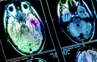 Богатство и мозг. Как доход влияет на нейронную активность у мужчин