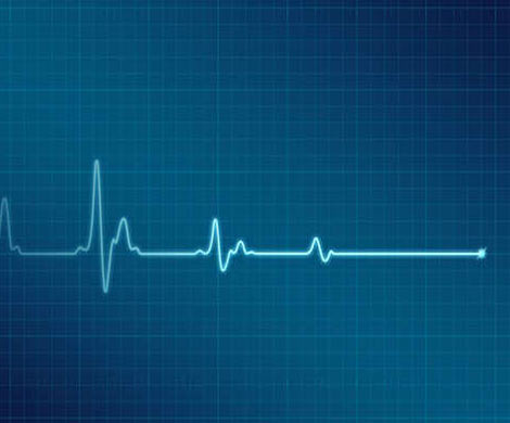 Дефектные гены могут заставить сердце остановиться?