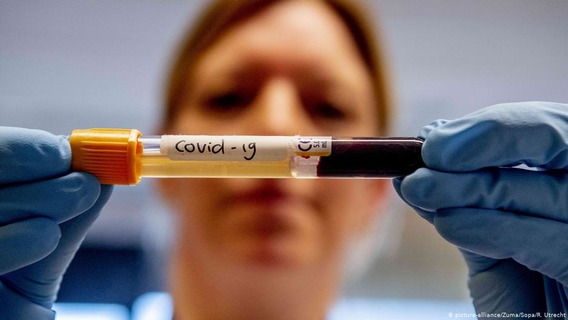 Фармацевтический гигант Pfizer начал тестировать экспериментальную вакцину от коронавируса в США Фармацевтический гигант Pfizer начал тестировать экспериментальную вакцину от коронавируса в США