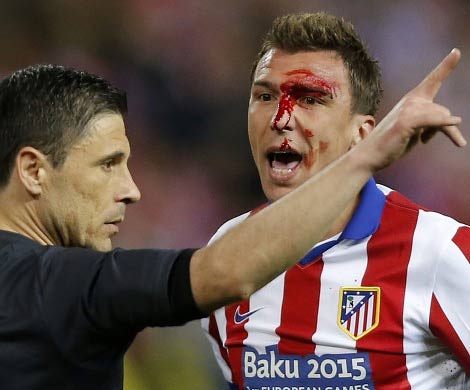 Форварду «Атлетико» разбили лицо в матче Лиги чемпионов с «Реалом»