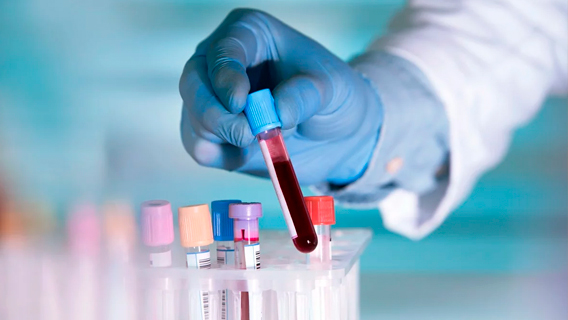 Люди с II группой крови более уязвимы к заражению Covid-19