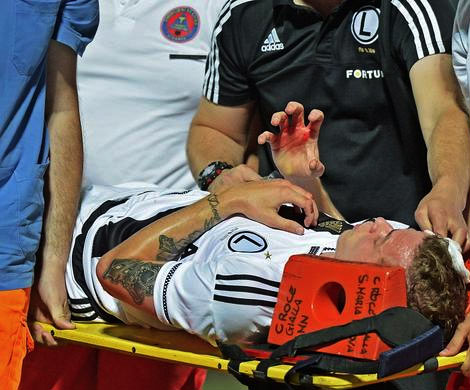 Матч Лиги Европы был прерван из-за прилетевшего в голову игрока камня