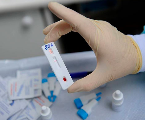 Минздрав РФ заявил о стабилизации уровня заболеваемости ВИЧ 