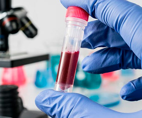 Новый метод дает надежду в борьбе против рака крови