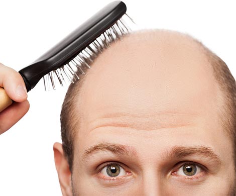 Определены основные причины выпадения волос