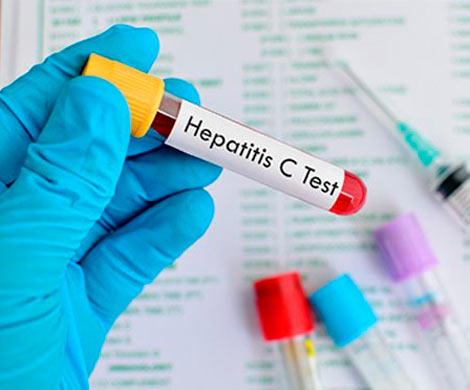 Роспотребднадзор пугает эпидемией гепатита 