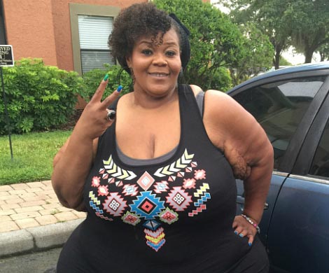 Самая толстая женщина в мире похудела на 230 килограммов