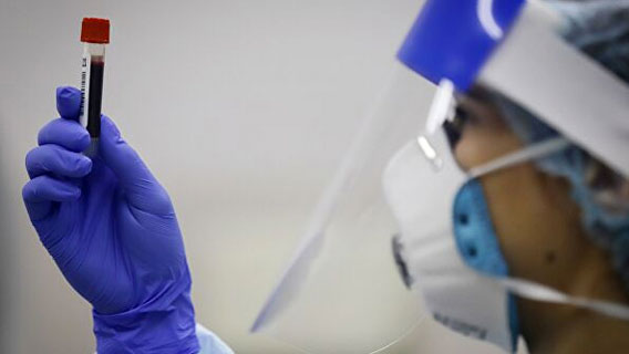 Согласно исследованию Гарварда, распространение коронавируса в Ухане могло начаться в августе