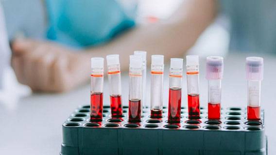 Стартапы, специализирующиеся на анализе крови, процветают, несмотря на крах Theranos