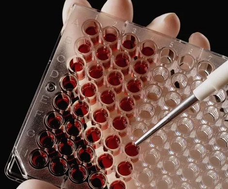Ученые приблизились к созданию лекарства от ВИЧ‍