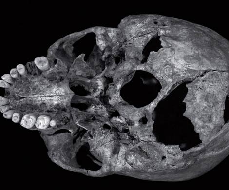 Ученые связали гибель Ричарда III с ранением в основание черепа