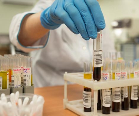 Ученые узнали, как группа крови влияет на потенцию мужчины Ученые узнали, как группа крови влияет на потенцию мужчины