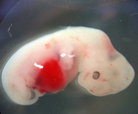 Ученые впервые создали зародыш с клетками человека и свиньи‍